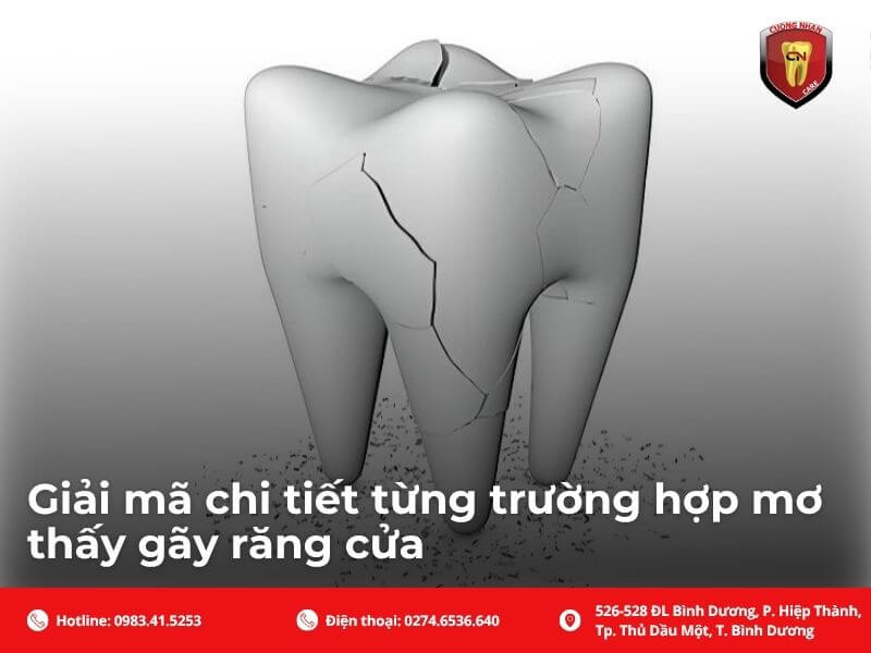 Giải mã chi tiết từng trường hợp mơ thấy gãy răng cửa