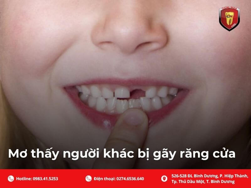 Mơ thấy người khác bị gãy răng cửa