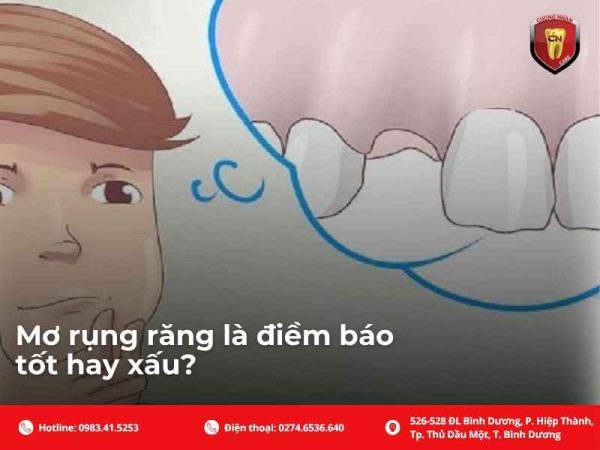 Mơ rụng răng là điềm báo tốt hay xấu?