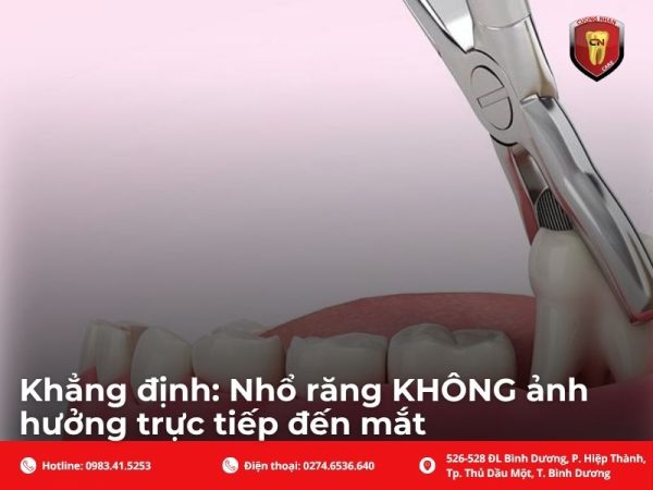 Khẳng định: Nhổ răng KHÔNG ảnh hưởng trực tiếp đến mắt