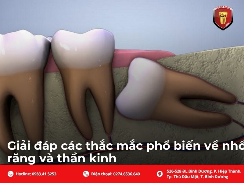 Giải đáp các thắc mắc phổ biến về nhổ răng và thần kinh