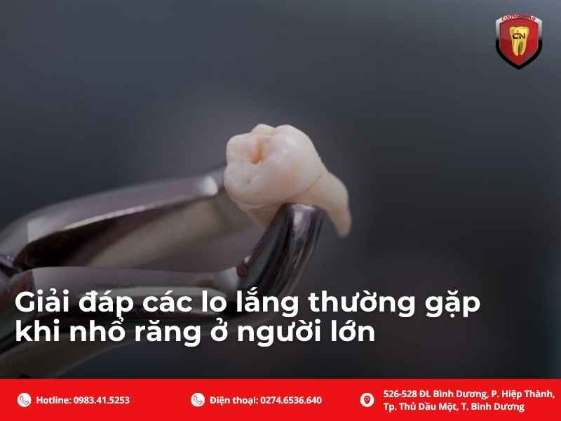 Hướng dẫn chăm sóc sau khi nhổ răng để mau lành thương, tránh biến chứng