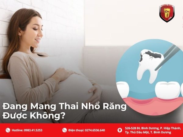 Việc nhổ răng khi mang thai 3 tháng đầu là điều các bác sĩ luôn khuyến cáo nên tránh