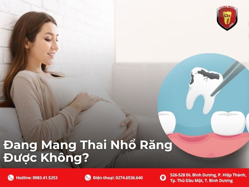 Việc nhổ răng khi mang thai 3 tháng đầu là điều các bác sĩ luôn khuyến cáo nên tránh