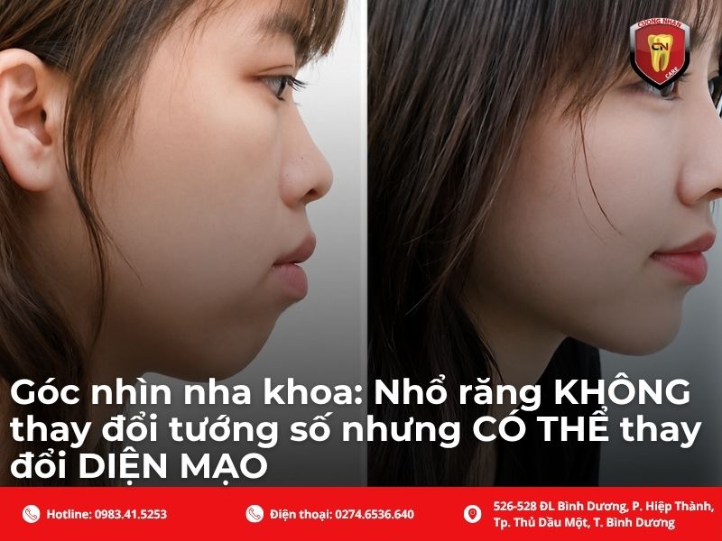 Góc nhìn nha khoa: Nhổ răng KHÔNG thay đổi tướng số nhưng CÓ THỂ thay đổi DIỆN MẠO