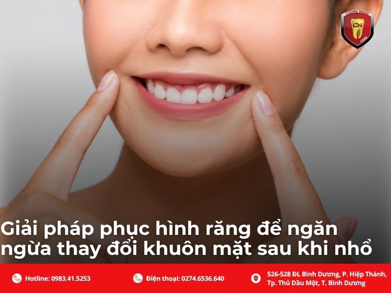 Giải pháp phục hình răng để ngăn ngừa thay đổi khuôn mặt sau khi nhổ