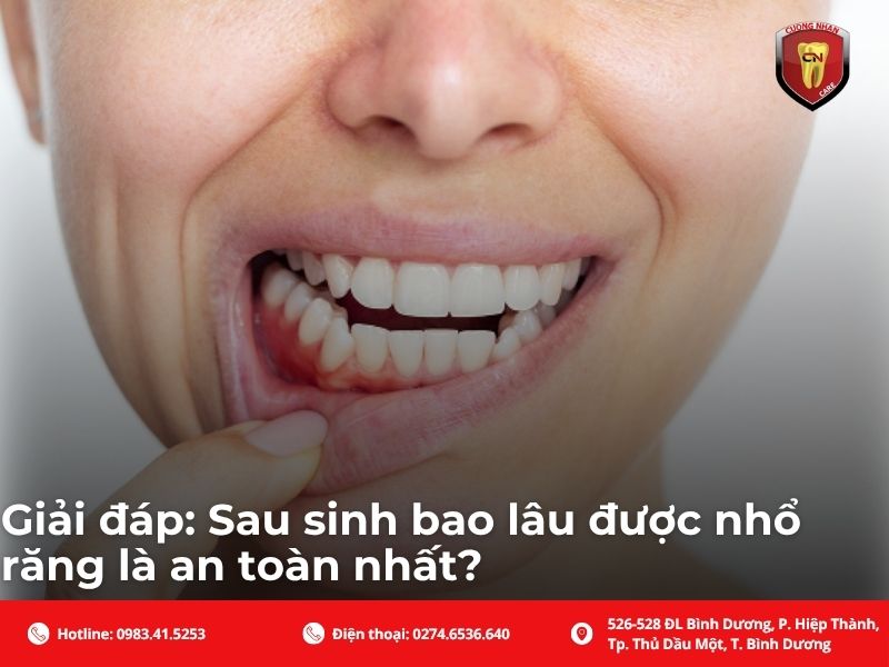 Giải đáp: Sau sinh bao lâu được nhổ răng là an toàn nhất?