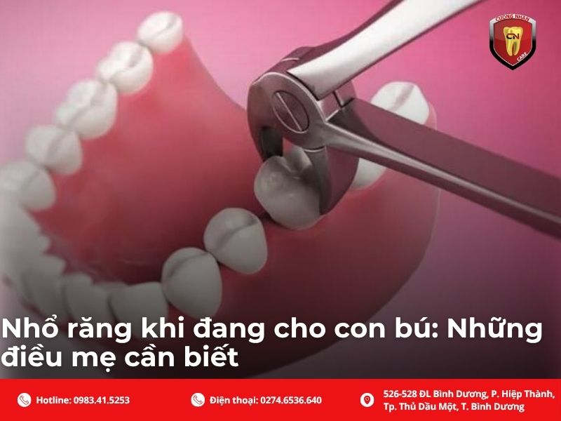 Nhổ răng khi đang cho con bú: Những điều mẹ cần biết