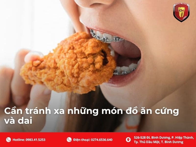 Cần tránh xa những món đồ ăn cứng và dai