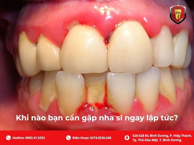 Khi nào bạn cần gặp nha sĩ ngay lập tức?