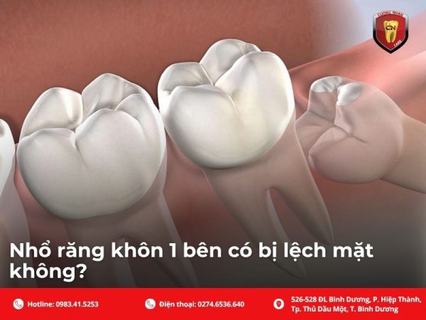 Cấu trúc xương hàm quyết định khuôn mặt, không phải răng