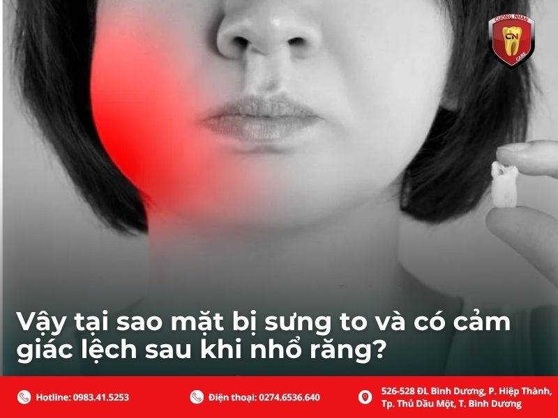 Sưng nề - Phản ứng hoàn toàn tự nhiên và tạm thời của cơ thể