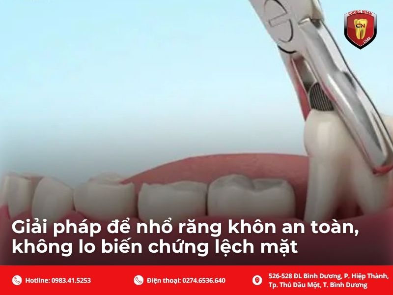 Giải pháp để nhổ răng khôn an toàn, không lo biến chứng lệch mặt