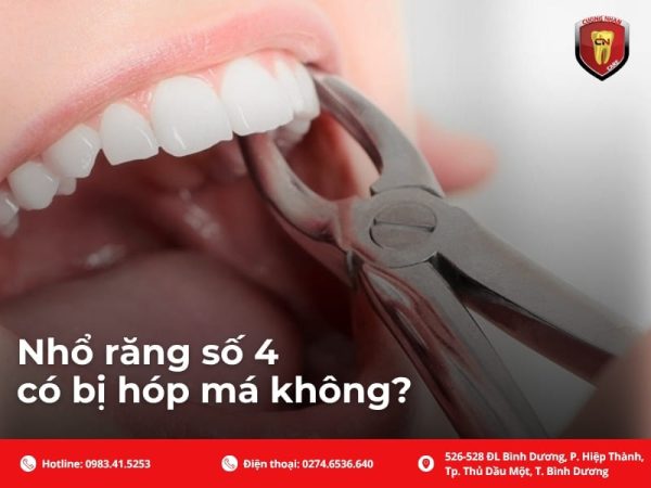 Nhổ răng số 4 có bị hóp má không?