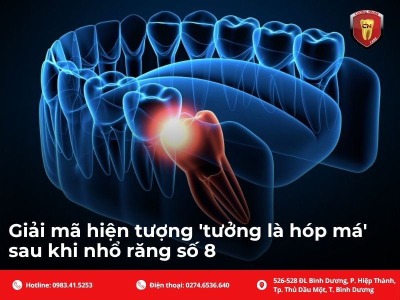 Cảm giác 'hóp má' thực chất là do mặt đã hết sưng trở về bình thường