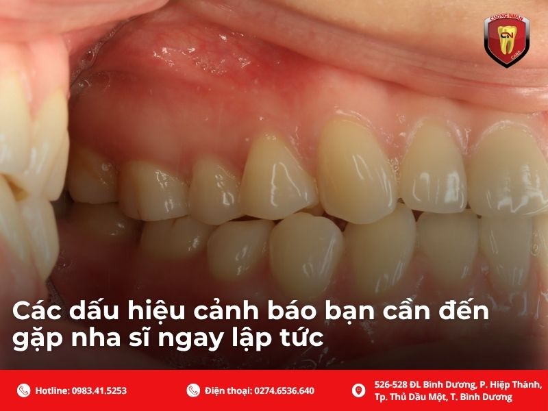 Giải đáp thắc mắc: Sưng nướu răng có tự hết không và kéo dài bao lâu?