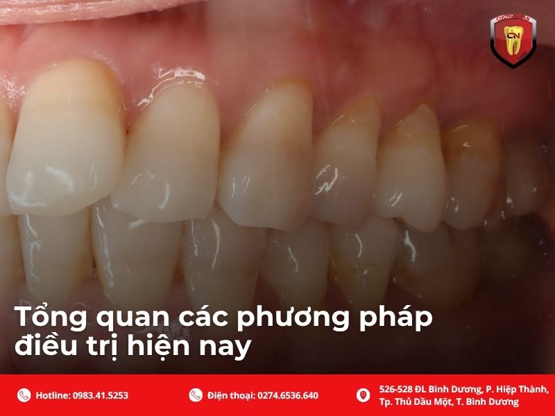 Tổng quan các phương pháp điều trị hiện nay