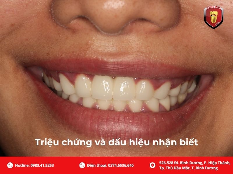 Triệu chứng và dấu hiệu nhận biết