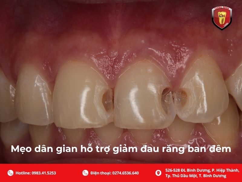 Uống thuốc gì khi bị đau răng ban đêm?