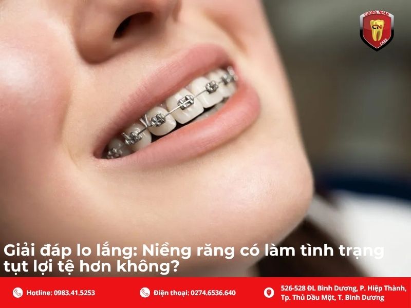Giải đáp lo lắng: Niềng răng có làm tình trạng tụt lợi tệ hơn không?