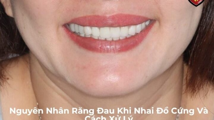 Nguyên Nhân Răng Đau Khi Nhai Đồ Cứng Và Cách Xử Lý