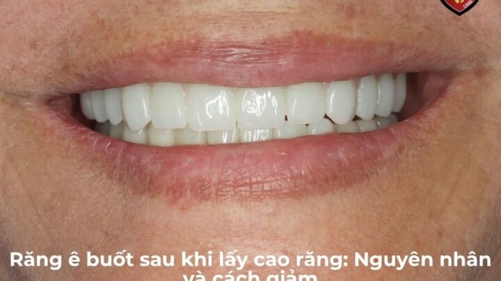 Răng Ê Buốt Sau Khi Lấy Cao Răng: Nguyên Nhân Và Cách Giảm