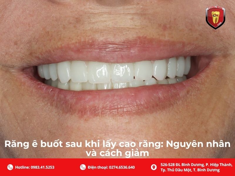 Răng ê buốt sau khi lấy cao răng: Nguyên nhân và cách giảm