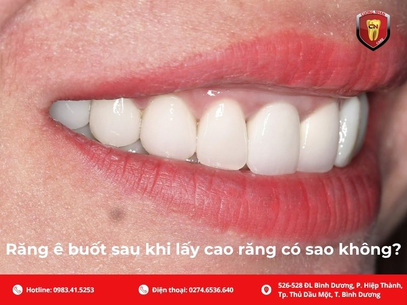 Răng ê buốt sau khi lấy cao răng có sao không?