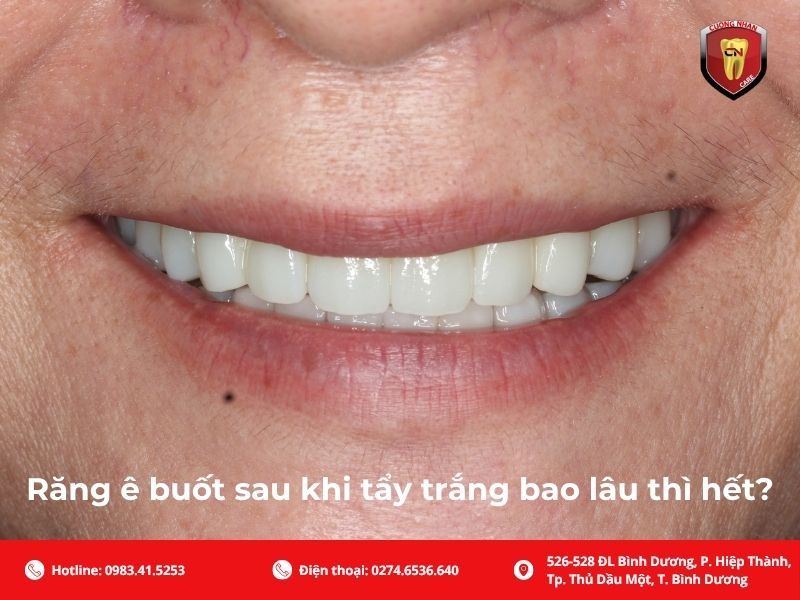 Răng ê buốt sau khi tẩy trắng bao lâu thì hết?