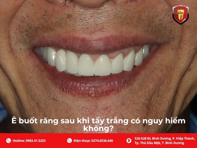 Ê buốt răng sau khi tẩy trắng có nguy hiểm không?