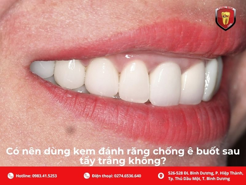 Có nên dùng kem đánh răng chống ê buốt sau tẩy trắng không?