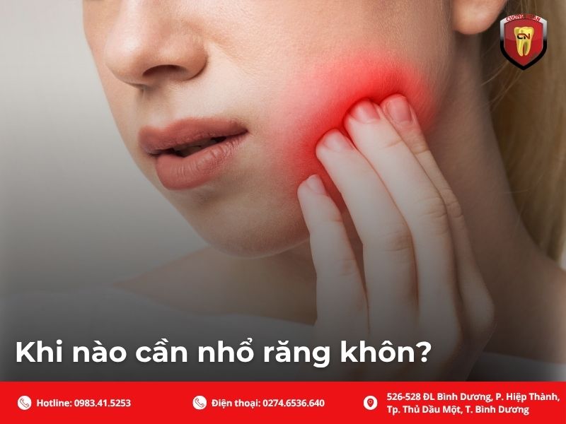 Khi nào cần nhổ răng khôn?