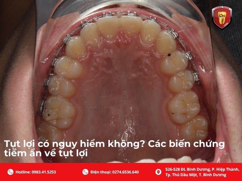 Ảnh hưởng đến thẩm mỹ và sự tự tin