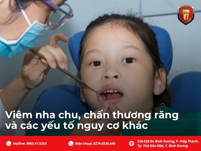 Viêm nha chu, chấn thương răng và các yếu tố nguy cơ khác