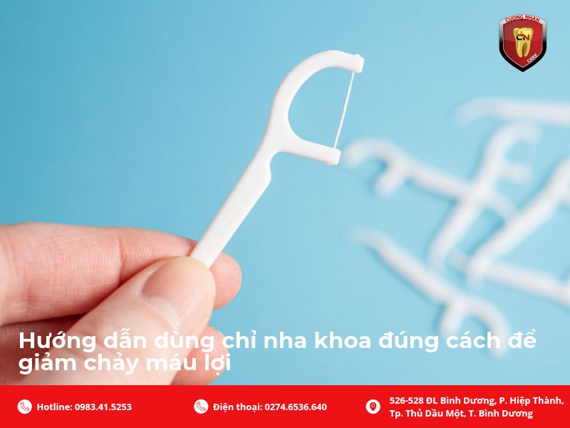 Hướng dẫn dùng chỉ nha khoa đúng cách để giảm chảy máu lợi
