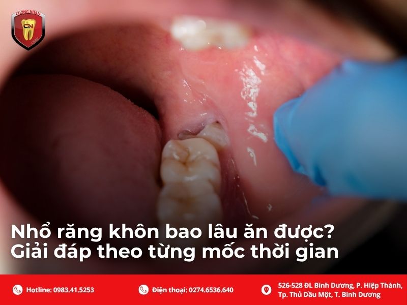 Nhổ răng khôn bao lâu ăn được? Giải đáp theo từng mốc thời gian