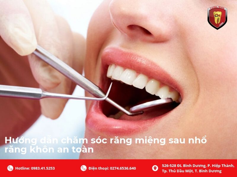 Hướng dẫn chăm sóc răng miệng sau nhổ răng khôn an toàn