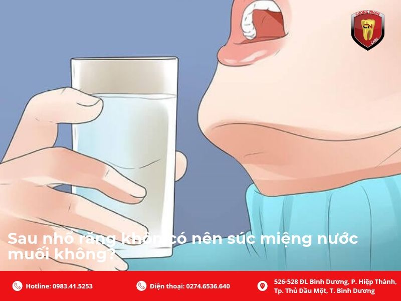 Sau nhổ răng khôn có nên súc miệng nước muối không?