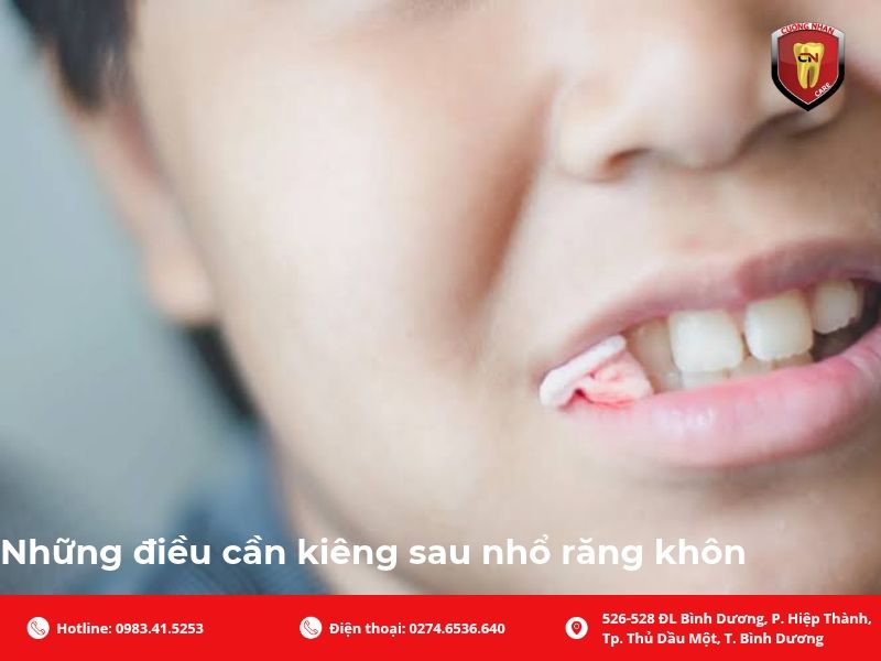 Những điều cần kiêng sau nhổ răng khôn