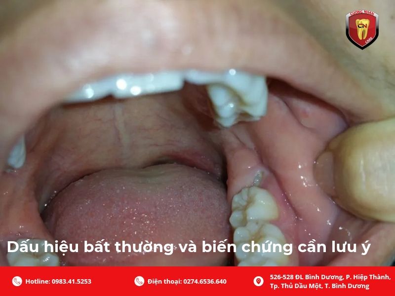 Dấu hiệu bất thường và biến chứng cần lưu ý