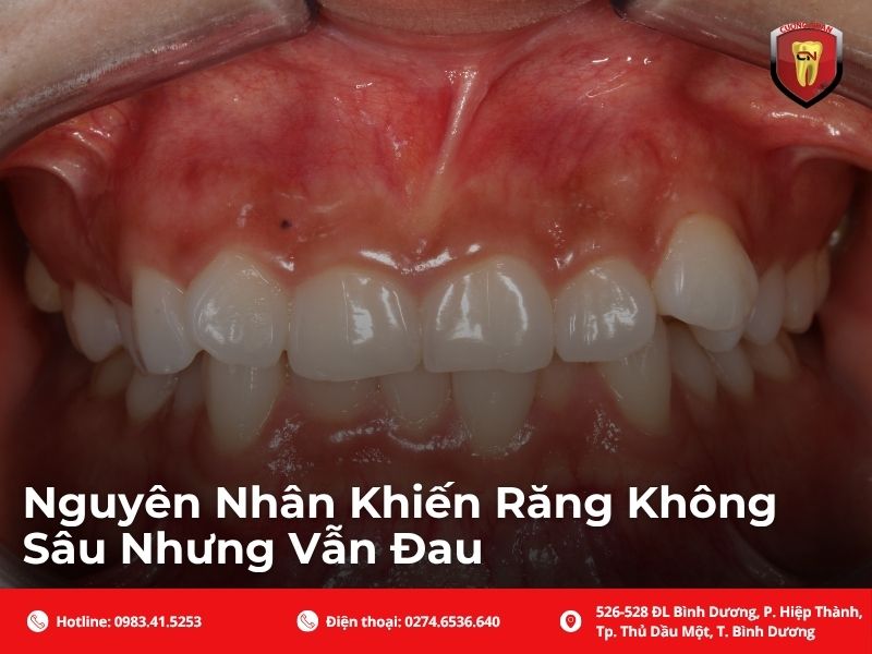 Nguyên nhân khiến răng không sâu nhưng vẫn đau