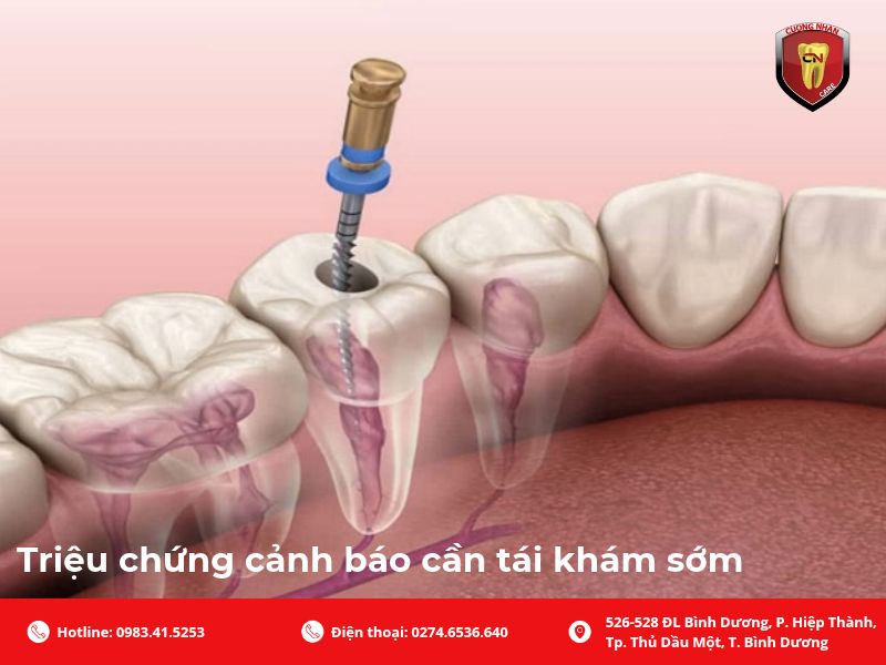 Nguyên nhân răng lấy tuỷ xong vẫn đau kéo dài